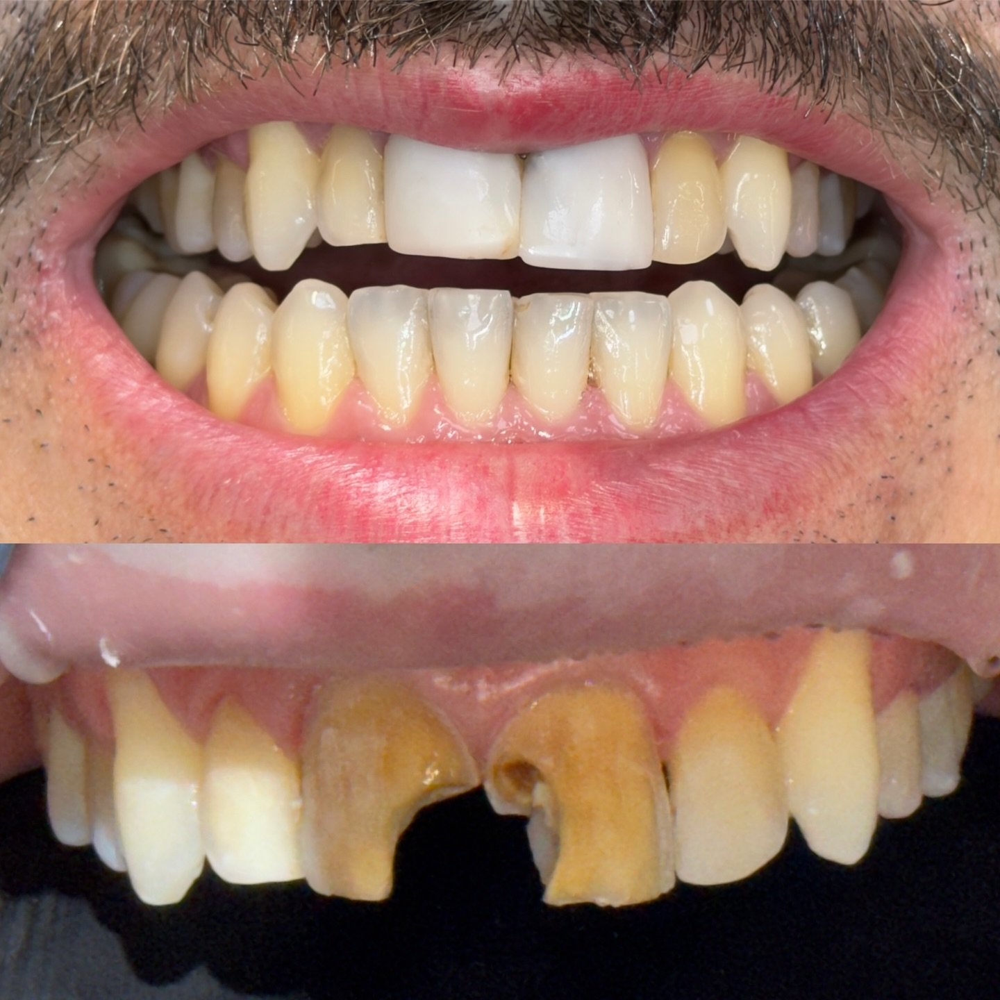 Antes e Depois 2